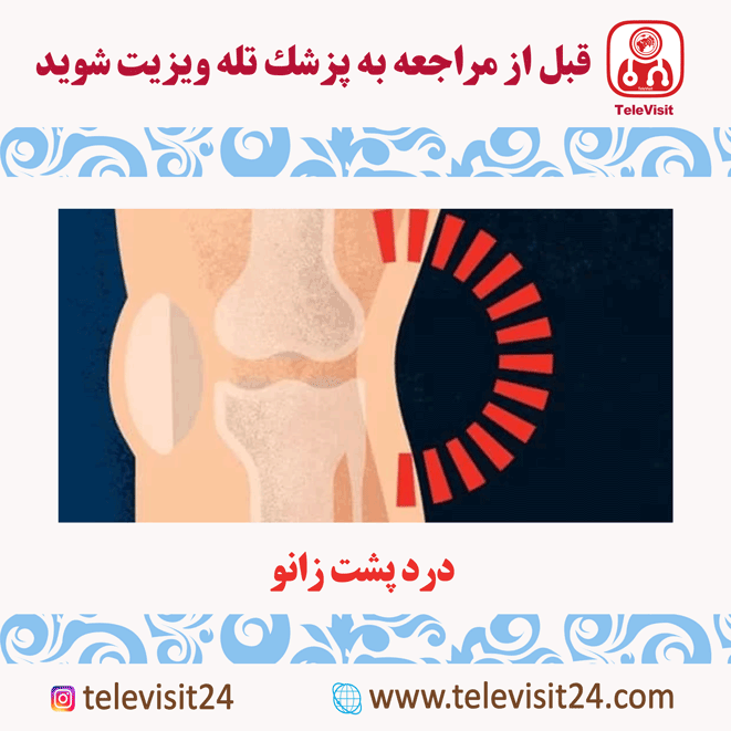 درد پشت زانو