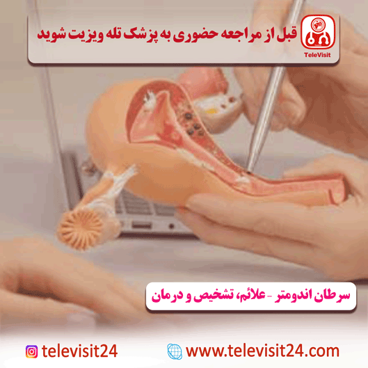 سرطان اندومتر – علائم، تشخیص و درمان