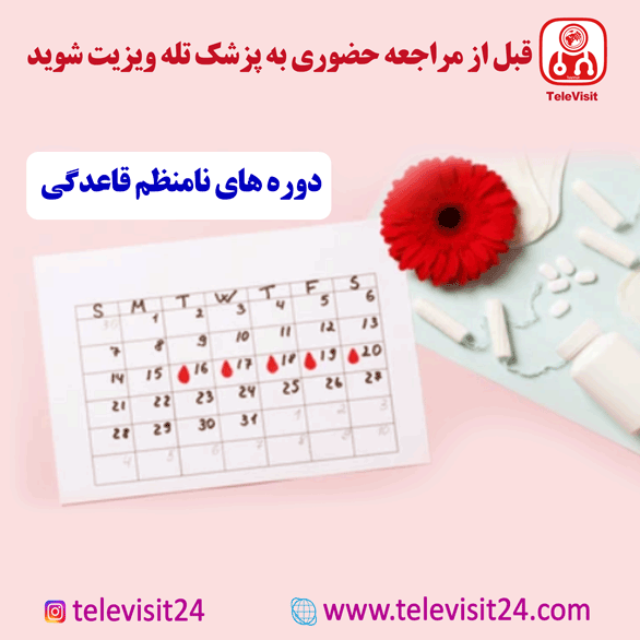 دوره های نامنظم قاعدگی