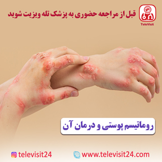 روماتیسم پوستی و درمان آن