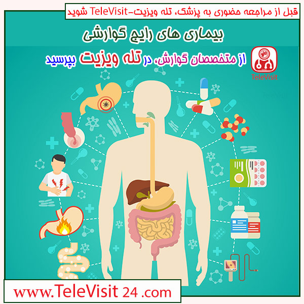 بیماری های رایج گوارشی