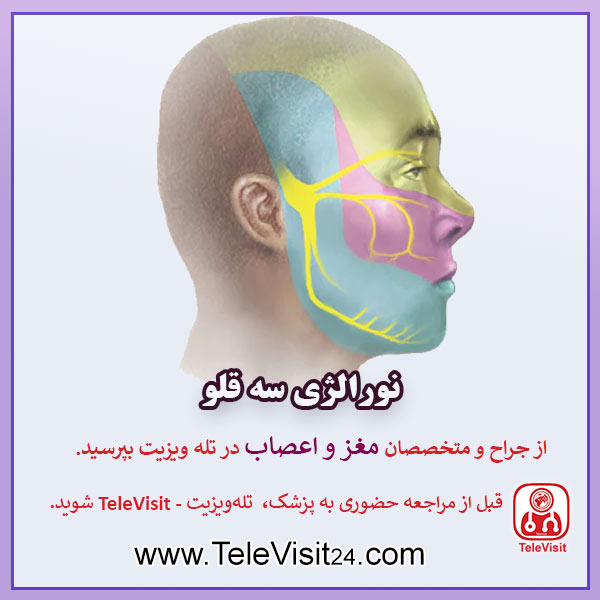 نورالژی سه قلو
