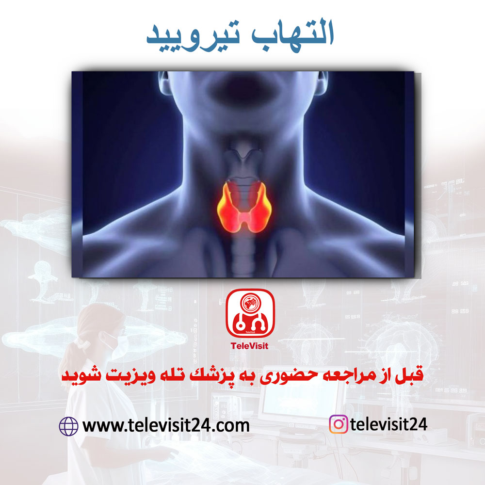 التهاب تیروئید