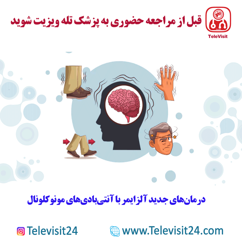 درمان‌های جدید آلزایمر با آنتی‌بادی‌های مونوکلونال