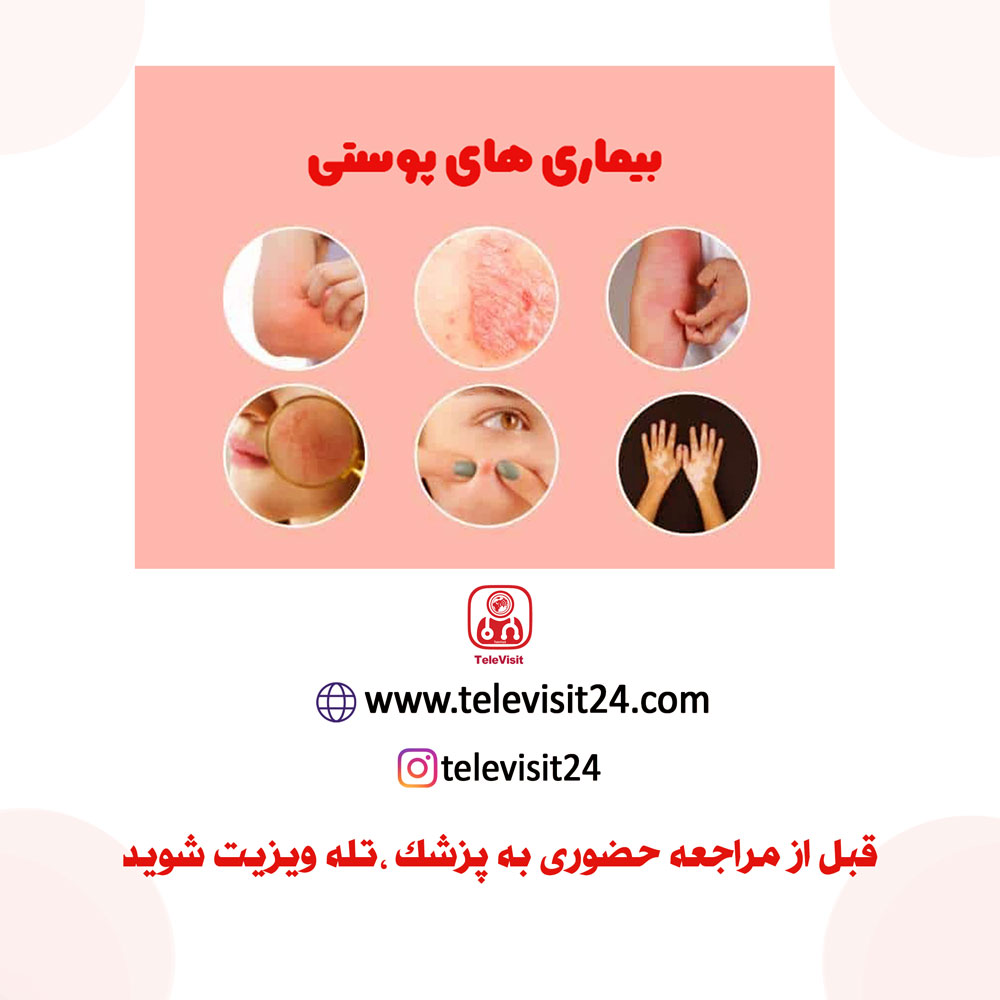 انواع بیماری‌ها و آسیب‌های پوستی