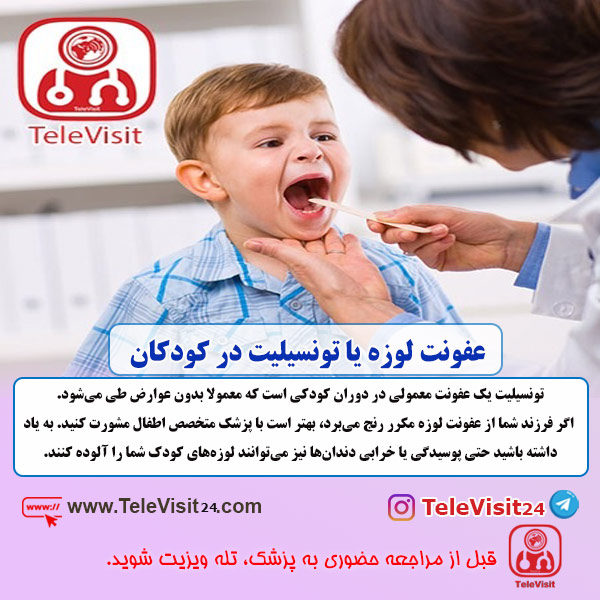 عفونت لوزه یا تونسیلیت در کودکان