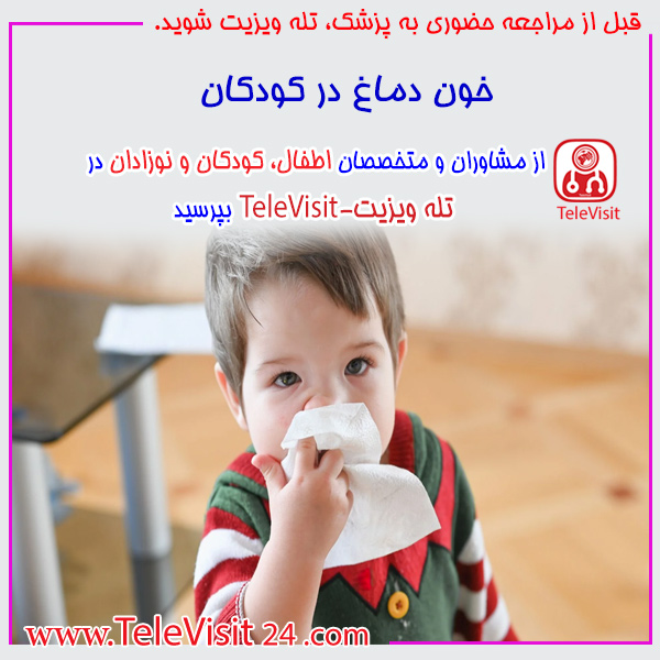 خون دماغ در کودکان