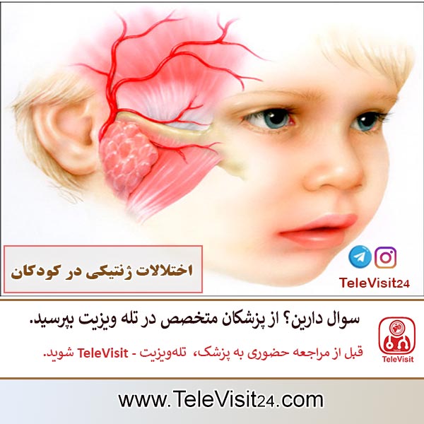 اختلالات ژنتیکی در کودکان