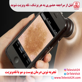 تجربه نوین درمان پوست و مو با تله‌ویزیت